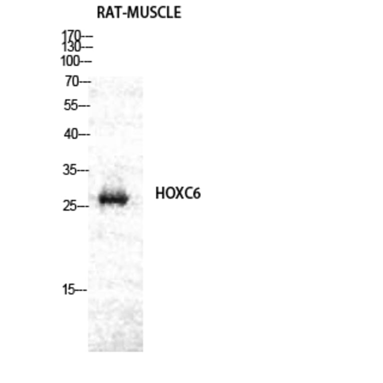 Western blot - Hox-C6 Polyclonal Antibody from Signalway Antibody (41032) - Antibodies.com