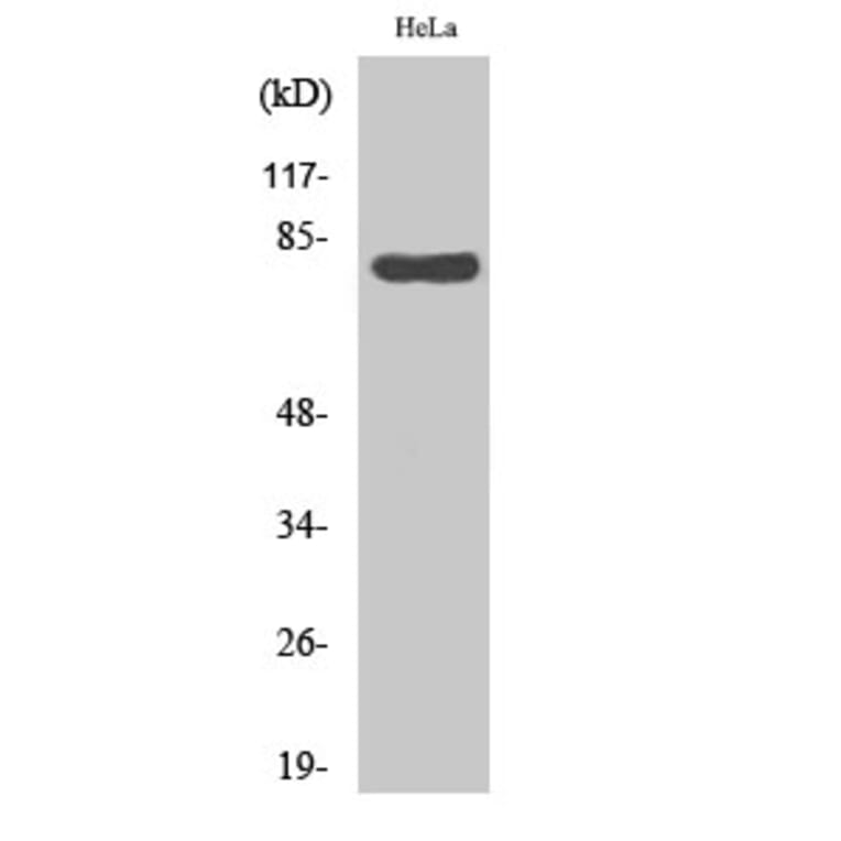 Western blot - HSP A5 Polyclonal Antibody from Signalway Antibody (41042) - Antibodies.com