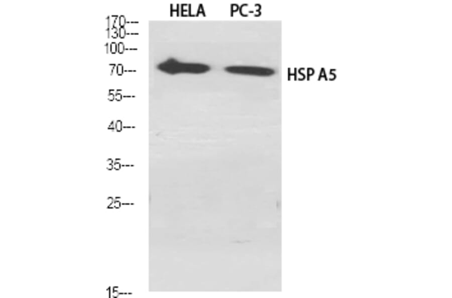 Western blot - HSP A5 Polyclonal Antibody from Signalway Antibody (41042) - Antibodies.com