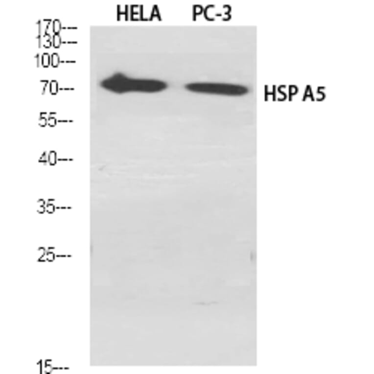 Western blot - HSP A5 Polyclonal Antibody from Signalway Antibody (41042) - Antibodies.com