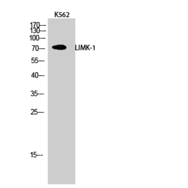 Western blot - LIMK-1 Polyclonal Antibody from Signalway Antibody (41107) - Antibodies.com