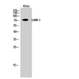 Western blot - LIMK-1 Polyclonal Antibody from Signalway Antibody (41107) - Antibodies.com