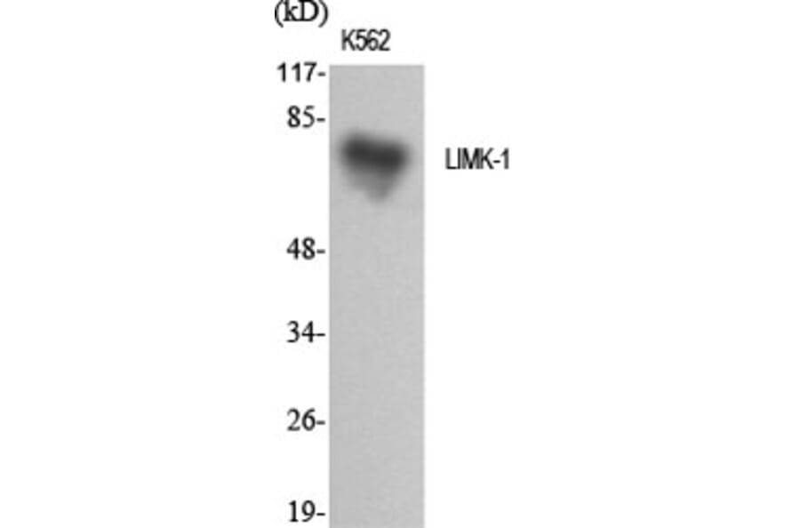 Western blot - LIMK-1 Polyclonal Antibody from Signalway Antibody (41107) - Antibodies.com
