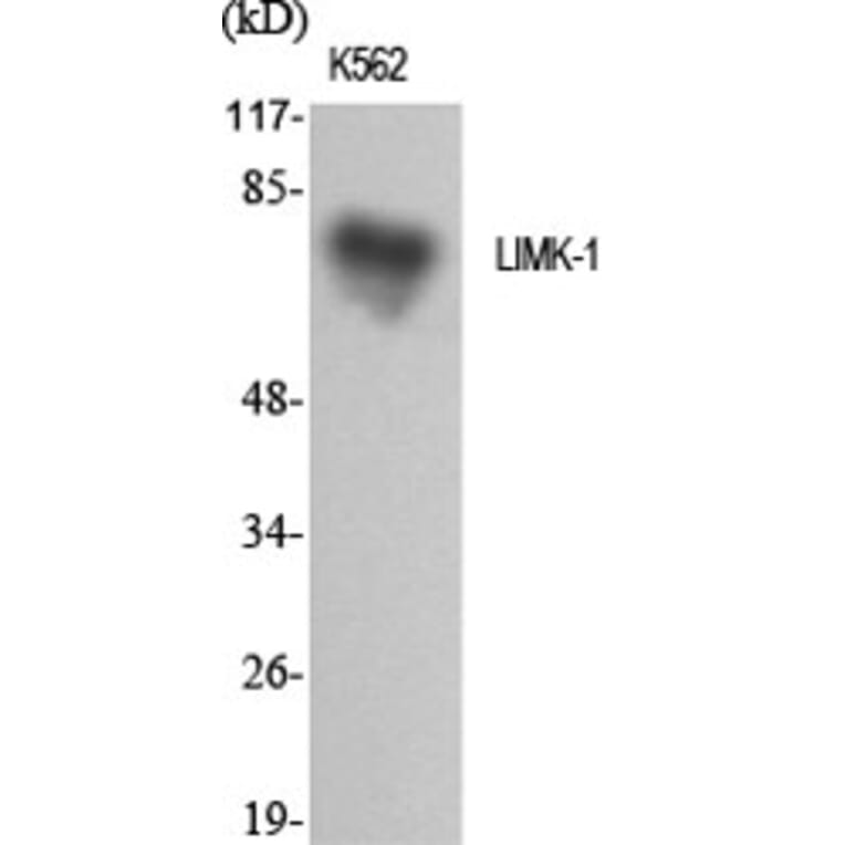 Western blot - LIMK-1 Polyclonal Antibody from Signalway Antibody (41107) - Antibodies.com