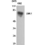 Western blot - LIMK-1 Polyclonal Antibody from Signalway Antibody (41107) - Antibodies.com