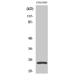 Western blot - LYPLA1 Polyclonal Antibody from Signalway Antibody (41116) - Antibodies.com
