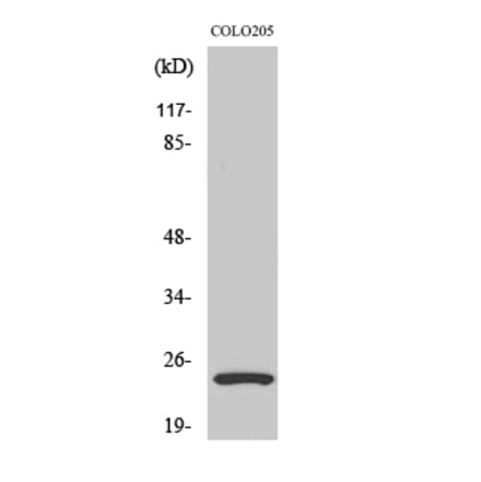 Western blot - LYPLA1 Polyclonal Antibody from Signalway Antibody (41116) - Antibodies.com