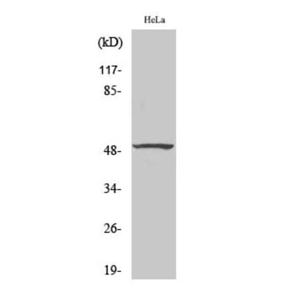 Western blot - SMAP45 Polyclonal Antibody from Signalway Antibody (41446) - Antibodies.com