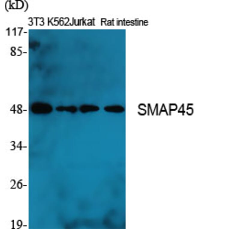 Western blot - SMAP45 Polyclonal Antibody from Signalway Antibody (41446) - Antibodies.com