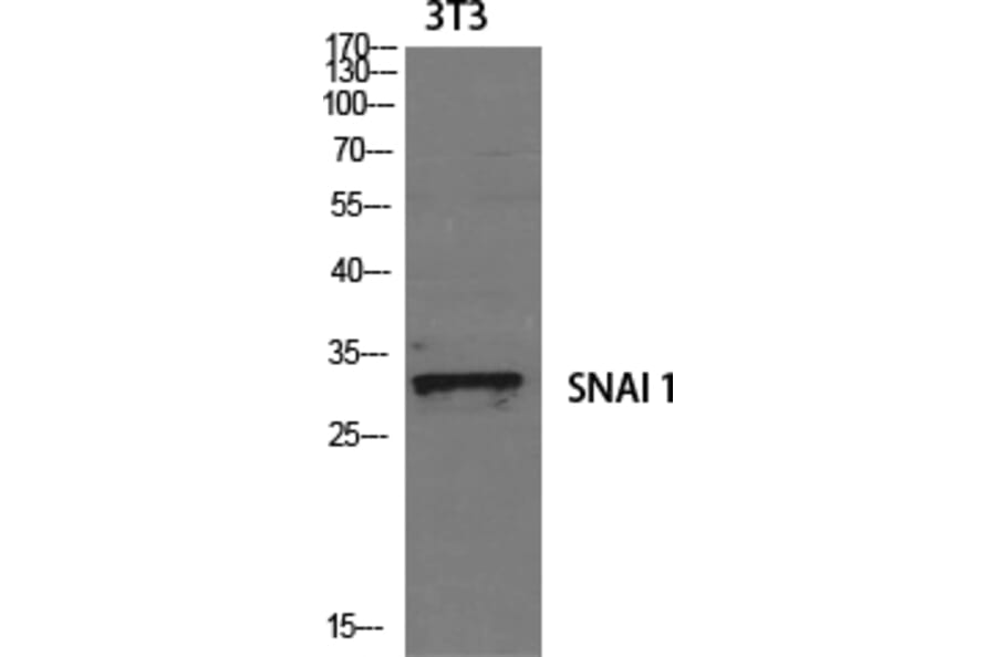 Western blot - SNAI 1 Polyclonal Antibody from Signalway Antibody (41449) - Antibodies.com