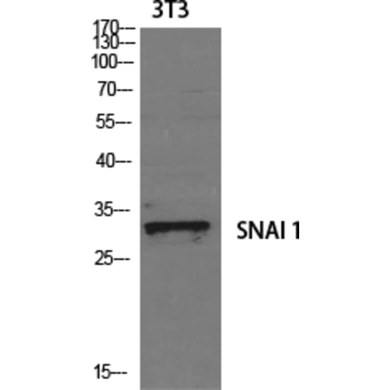 Western blot - SNAI 1 Polyclonal Antibody from Signalway Antibody (41449) - Antibodies.com