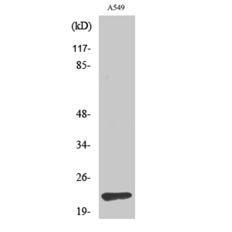 Western blot - TIMP-2 Polyclonal Antibody from Signalway Antibody (41500) - Antibodies.com