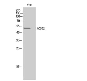 Western blot - ACOT2 Polyclonal Antibody from Signalway Antibody (40543) - Antibodies.com