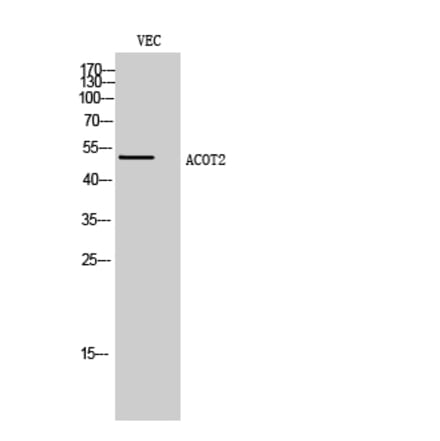 Western blot - ACOT2 Polyclonal Antibody from Signalway Antibody (40543) - Antibodies.com