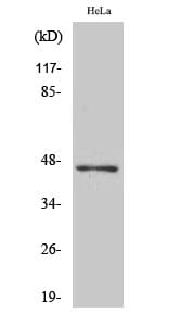 Western Blot analysis of COLO205 cells using ACOT4 Polyclonal Antibody