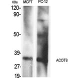 Western blot - ACOT8 Polyclonal Antibody from Signalway Antibody (40545) - Antibodies.com