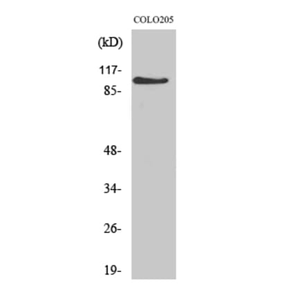 Western blot - AF-10 Polyclonal Antibody from Signalway Antibody (40557) - Antibodies.com