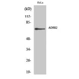 Western blot - AR-β2 Polyclonal Antibody from Signalway Antibody (40616) - Antibodies.com