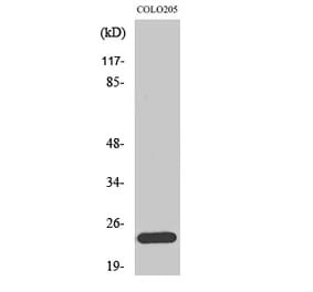 Western blot - Bcl-w Polyclonal Antibody from Signalway Antibody (40641) - Antibodies.com