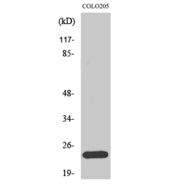 Western blot - Bcl-w Polyclonal Antibody from Signalway Antibody (40641) - Antibodies.com