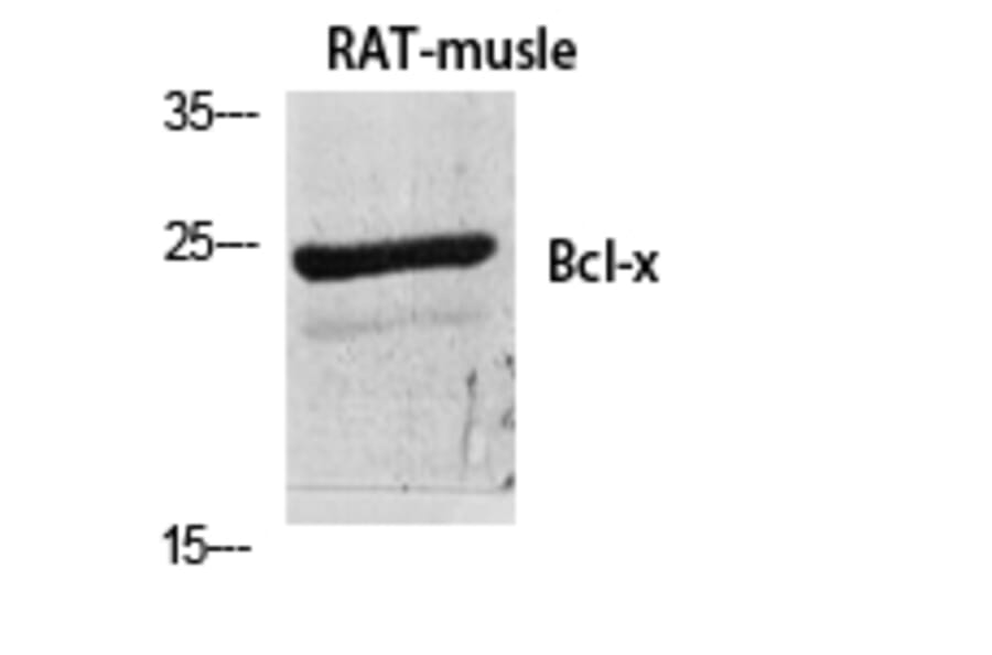 Western blot - Bcl-x Polyclonal Antibody from Signalway Antibody (40642) - Antibodies.com