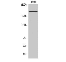 Western blot - BRCA1 Polyclonal Antibody from Signalway Antibody (40655) - Antibodies.com