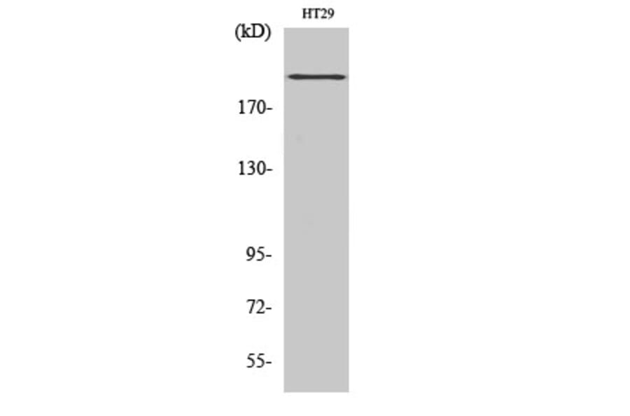 Western blot - BRCA1 Polyclonal Antibody from Signalway Antibody (40655) - Antibodies.com