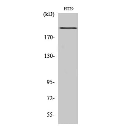 Western blot - BRCA1 Polyclonal Antibody from Signalway Antibody (40655) - Antibodies.com