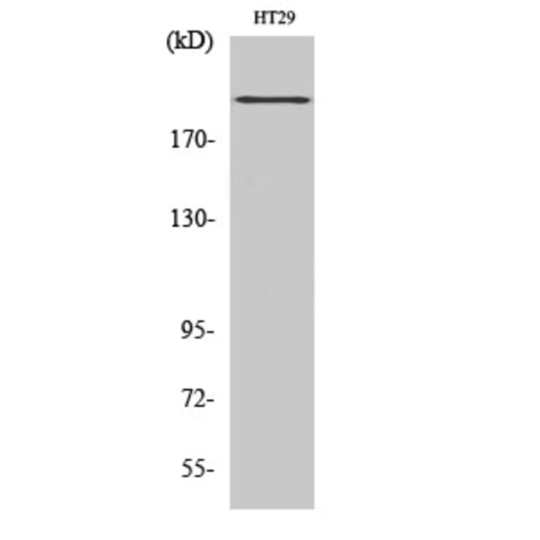 Western blot - BRCA1 Polyclonal Antibody from Signalway Antibody (40655) - Antibodies.com