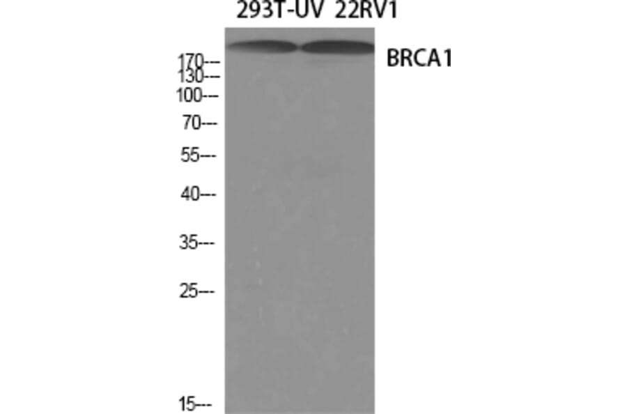 Western blot - BRCA1 Polyclonal Antibody from Signalway Antibody (40655) - Antibodies.com