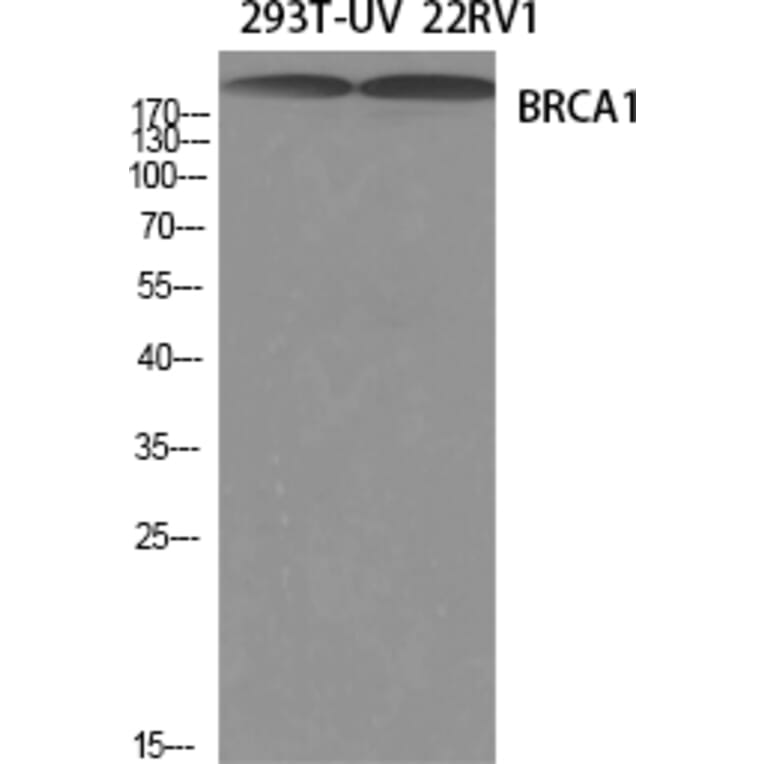 Western blot - BRCA1 Polyclonal Antibody from Signalway Antibody (40655) - Antibodies.com