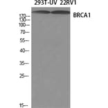 Western blot - BRCA1 Polyclonal Antibody from Signalway Antibody (40655) - Antibodies.com