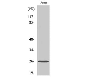 Western blot - C1q-B Polyclonal Antibody from Signalway Antibody (40660) - Antibodies.com