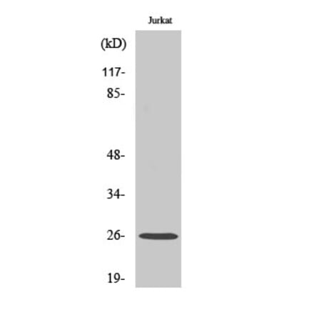 Western blot - C1q-B Polyclonal Antibody from Signalway Antibody (40660) - Antibodies.com