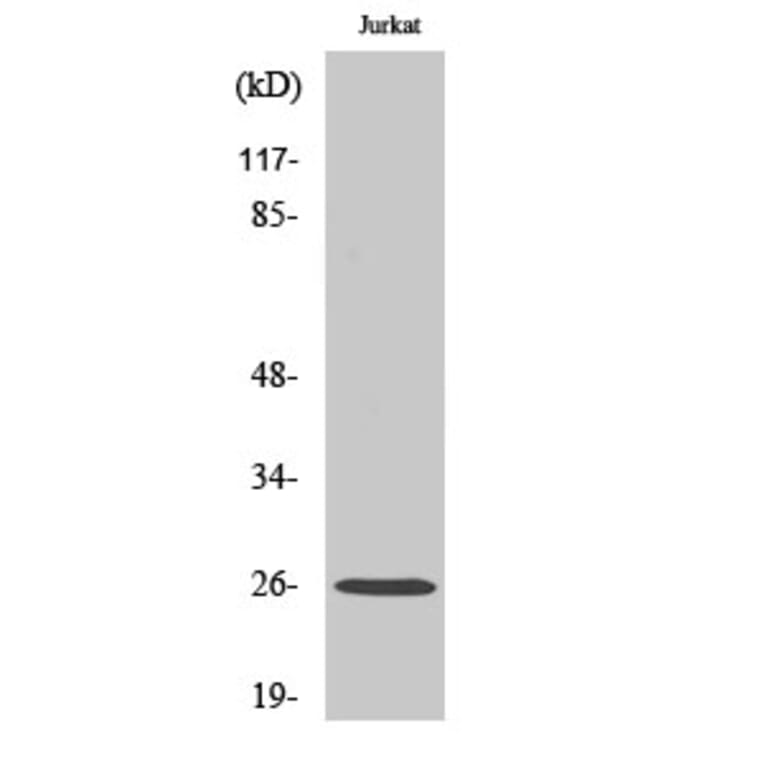 Western blot - C1q-B Polyclonal Antibody from Signalway Antibody (40660) - Antibodies.com
