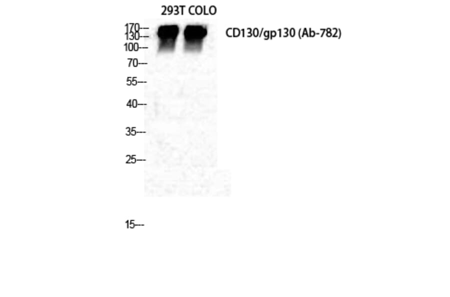 Western blot - CD130 Polyclonal Antibody from Signalway Antibody (40693) - Antibodies.com