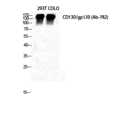 Western blot - CD130 Polyclonal Antibody from Signalway Antibody (40693) - Antibodies.com