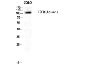 Western blot - c-Fms Polyclonal Antibody from Signalway Antibody (40729) - Antibodies.com