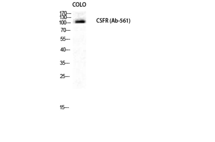 Western blot - c-Fms Polyclonal Antibody from Signalway Antibody (40729) - Antibodies.com