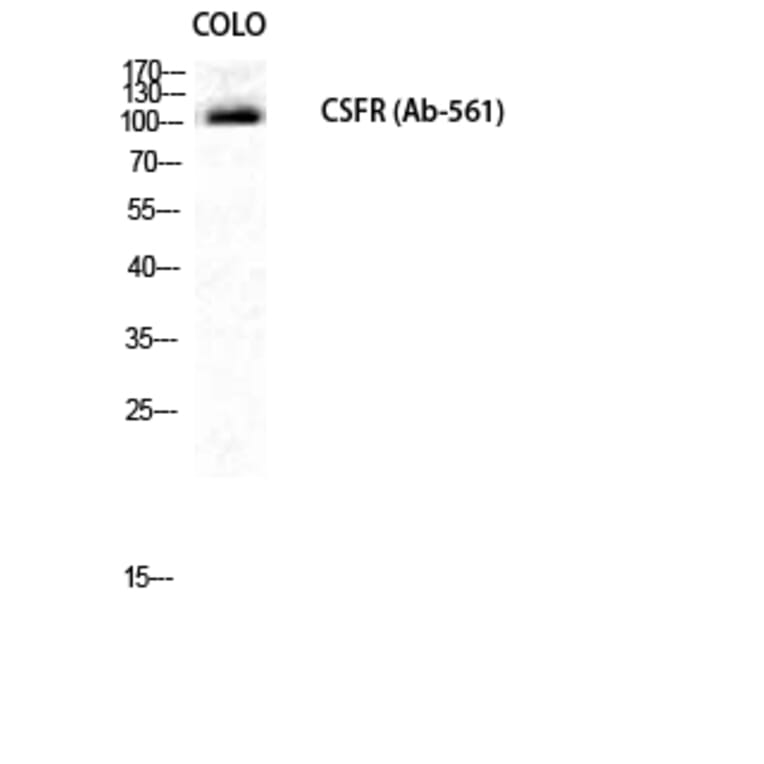 Western blot - c-Fms Polyclonal Antibody from Signalway Antibody (40729) - Antibodies.com