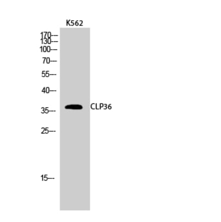 Western blot - CLP36 Polyclonal Antibody from Signalway Antibody (40761) - Antibodies.com