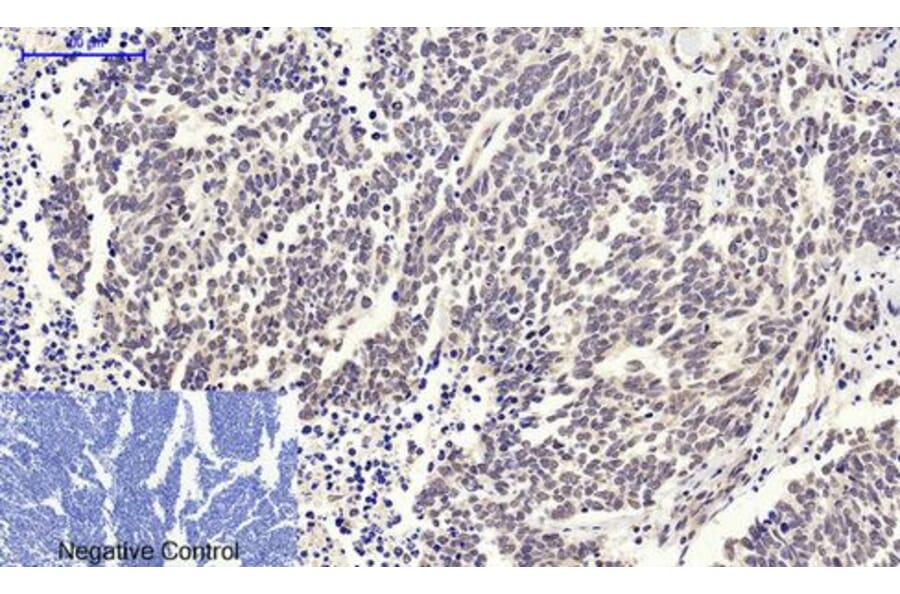Immunohistochemistry - c-Myc Polyclonal Antibody from Signalway Antibody (40765) - Antibodies.com