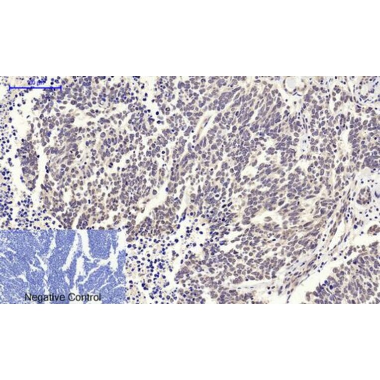 Immunohistochemistry - c-Myc Polyclonal Antibody from Signalway Antibody (40765) - Antibodies.com