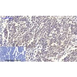 Immunohistochemistry - c-Myc Polyclonal Antibody from Signalway Antibody (40765) - Antibodies.com