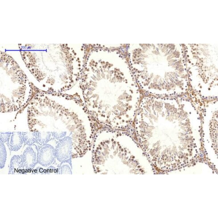 Immunohistochemistry - c-Myc Polyclonal Antibody from Signalway Antibody (40765) - Antibodies.com