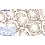 Immunohistochemistry - c-Myc Polyclonal Antibody from Signalway Antibody (40765) - Antibodies.com