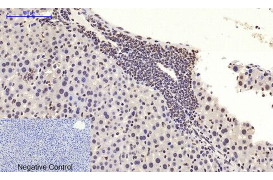 Immunohistochemistry - c-Myc Polyclonal Antibody from Signalway Antibody (40765) - Antibodies.com