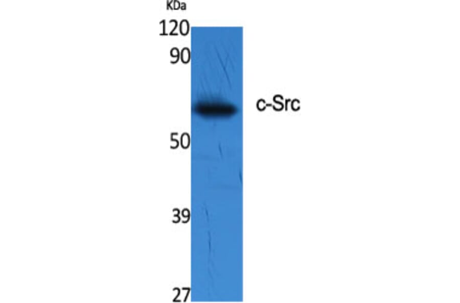 Western blot - c-Src Polyclonal Antibody from Signalway Antibody (40790) - Antibodies.com