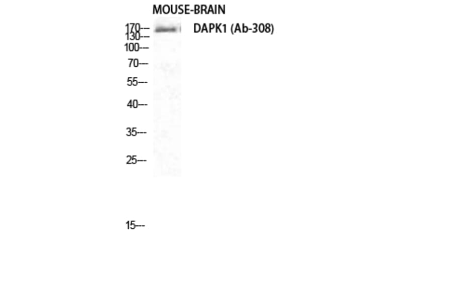 Western blot - DAPK1 Polyclonal Antibody from Signalway Antibody (40832) - Antibodies.com
