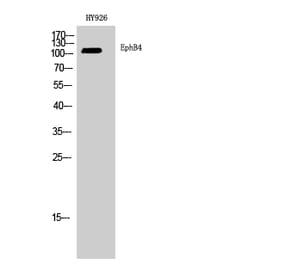 Western blot - EphB4 Polyclonal Antibody from Signalway Antibody (40891) - Antibodies.com